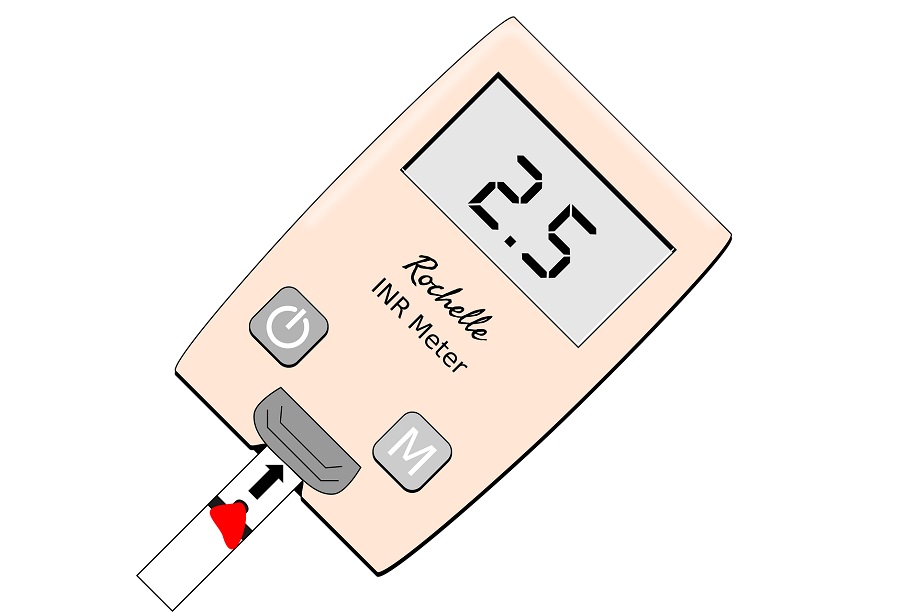 Efficacy of Hyperbaric Oxygen Chamber for Diabetes