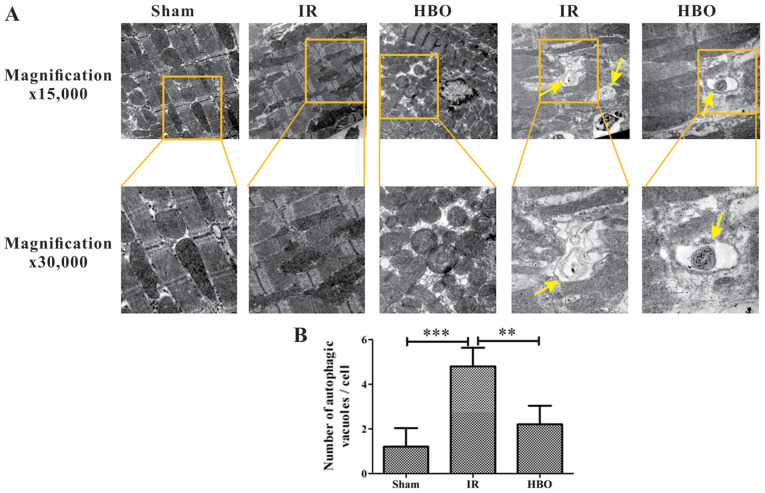 3-evaluation-of-cardioprotective-effects-of-hbot.png